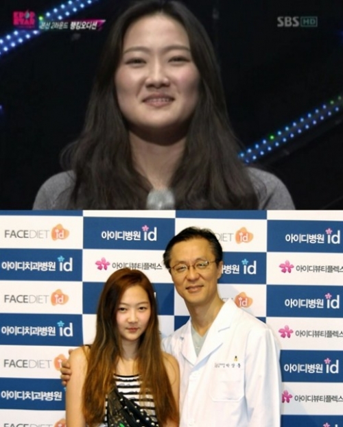 Сон Су Чжин из шоу талантов ‘K-поп Звезда’ сделала пластическую операцию?